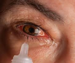 pink eye eye drops treatment and