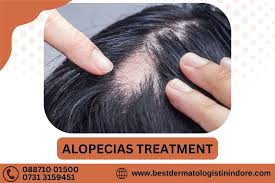 alopecia areata treatment in indore