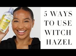 witch hazel skincare acne benefits