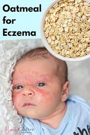 oatmeal for eczema a simple natural