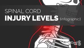 the spinal cord injury levels infographic