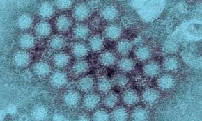 У чому відмінність норовірусу від ротавірусу