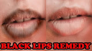 dark lips black chapped lips