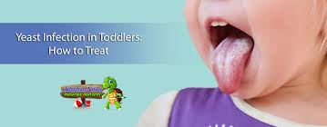 yeast infection in toddlers how to