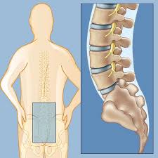 Sacroiliac and coccyx pain can also contribute to types of spine pain; Lower Back Pain Weill Cornell Brain And Spine Center