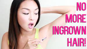 how to get rid of ingrown hairs you