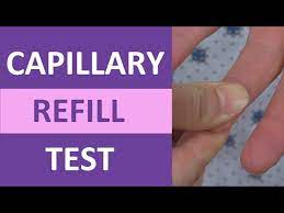 capillary refill time test normal vs