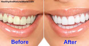 There are several ways to do so without putting your teeth and gums at risk with chemicals at first, i wasn't using it as often as i should but when i did, i noticed that my teeth slightly changed color. Naturally Whiten Your Teeth In 3 Minutes At Home Research Based
