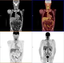 A pet scan can show how well certain parts of your body are working, rather than simply showing what they look like. What Is Pet Imaging Imaging Technology News