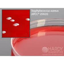 Columbia cna agar has traditionally been used to identify staphylococci and streptococci. Hardy Diagnostic A50 Dry Culture Media Columbia Cna Agar Plate 80 Day Shelf Life Pack Of 10 Ohaus Scale Magnetic Stirrer Vortex Mixer Sample Prep Centrifuge