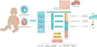 pathology of maple syrup urine disease