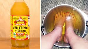 soak your feet in apple cider vinegar