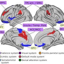 Top brain regions that explain gray matter differences related to SS.... |  Download Scientific Diagram