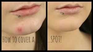how to cover a spot blemish you
