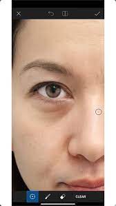 remove eye bags fabulously in photo