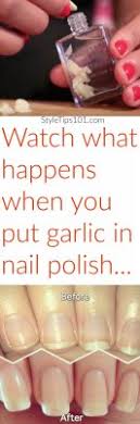 garlic in nail polish does garlic for