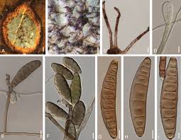 Cladophylls become soft rotted and abscise from the plant. The Genus Bipolaris Sciencedirect