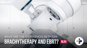 brachytherapy and ebrt