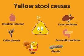 yellow 9 causes when to see