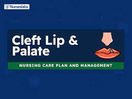 cleft palate nursing care plans