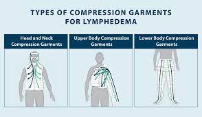 compression garments for lymphedema