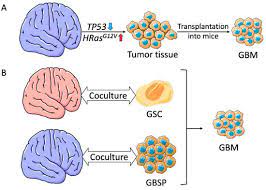 modeling human brain tumors