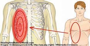 Rib cage pain may start in one area but travel to an area nearby. Pin On Kidney Cleans
