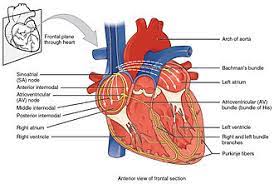Most cardiac arrests occur when a diseased heart's electrical system malfunctions. Cardiac Arrest Wikipedia