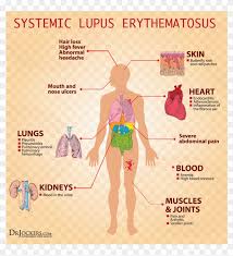 Symptoms Of Low Vitamin D Mayo Clinic Internal Organs Of