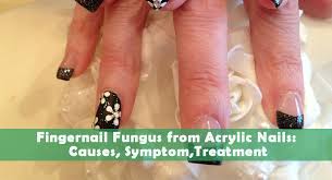 fingernail fungus from acrylic nails