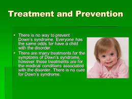 Down Syndrome Dental Management