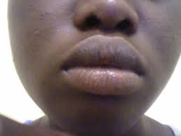 how can i get smaller lips without make