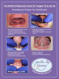 frenectomy questions