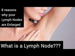 lymph node enlarged lymph nodes