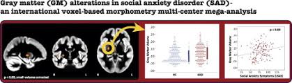 Check for platform availability and play today! Voxel Based Morphometry Multi Center Mega Analysis Of Brain Structure In Social Anxiety Disorder Sciencedirect
