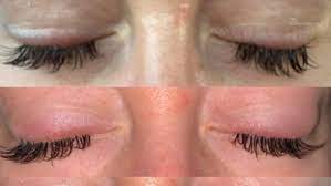 incorrectly applied eyelash extensions