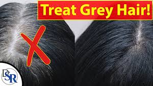 grey hair is caused by stress how to