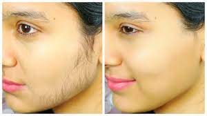 Facial hair removal products are a great way to keep yourself looking and feeling your best. Remove Facial Hair Permanently Ubtan Face Pack Anaysa Youtube