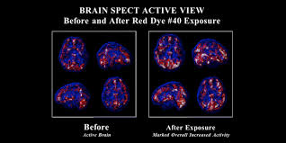 What are the side effects of red dye?