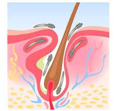 hair loss and demodex mites skalptec ltd