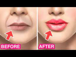 get plump lips bigger lips and fuller