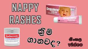 how to prevent diaper rashes sinhala