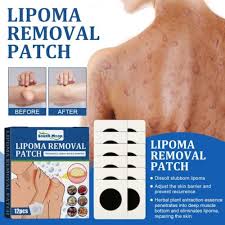unbranded 12x lipoma removal cream