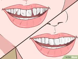 The best way to straighten teeth without braces involves using some sort of cle. How To Straighten Your Teeth Without Braces With Pictures