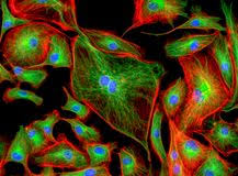 Imagen Del Microscopio De Fluorescencia De Las Células Humanas Que  Experimentan La Mitosis Stock de ilustración - Ilustración de imagen,  microscopio: 100397657