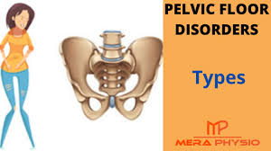 pelvic floor disorders types of