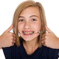 An underbite is also referred to as mandibular prognathism or a class iii. Is Orthodontic Headgear Necessary Henry Orthodontics Laurinburg North Carolina