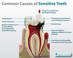 why are my teeth so sensitive