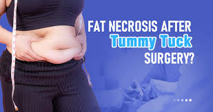how to treat fat necrosis after tummy