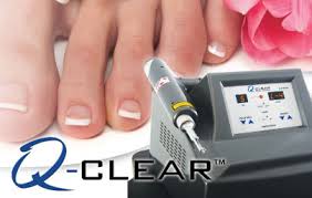 q clear laser treatment for fungal toenails